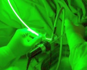 Prostata Behandlung greenlight-laser
